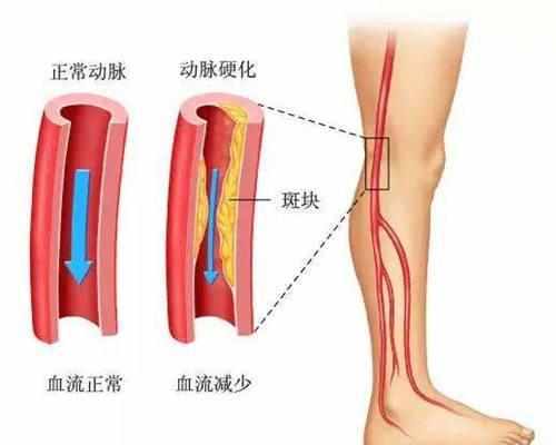 下载 (1).jpg