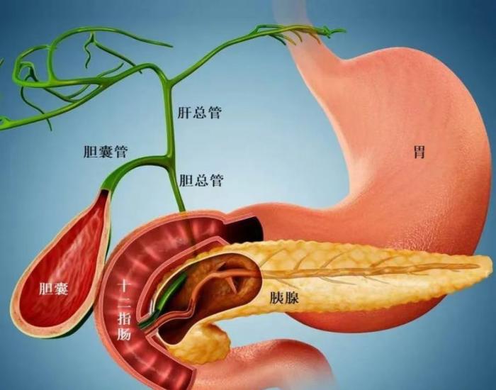 腹痛难忍？警惕胆结石悄悄引发急性胰腺炎1 (1).jpg
