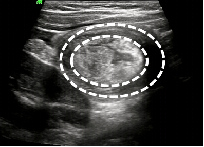 image003.png image003.png